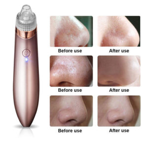 Blackhead Remover Face Acne Black Dot Pimple Electric Blackhead Vacuum Cleaner Pore Skin Care Tools Machine 4 Replacement Head - Techtopia